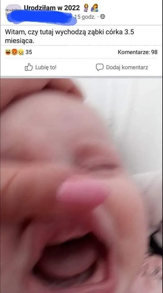 Witam czy tutaj wychodzą ząbki
