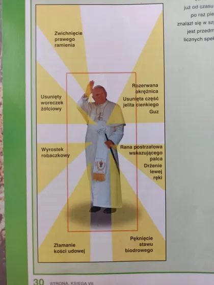 Choroby i urazy Jana Pawła Drugiego